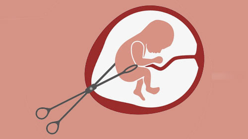 Abortion Services