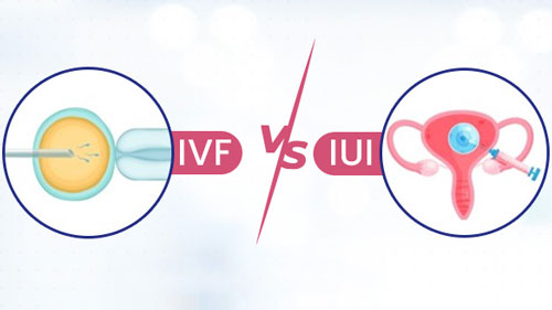 IUI / IVF Treatment